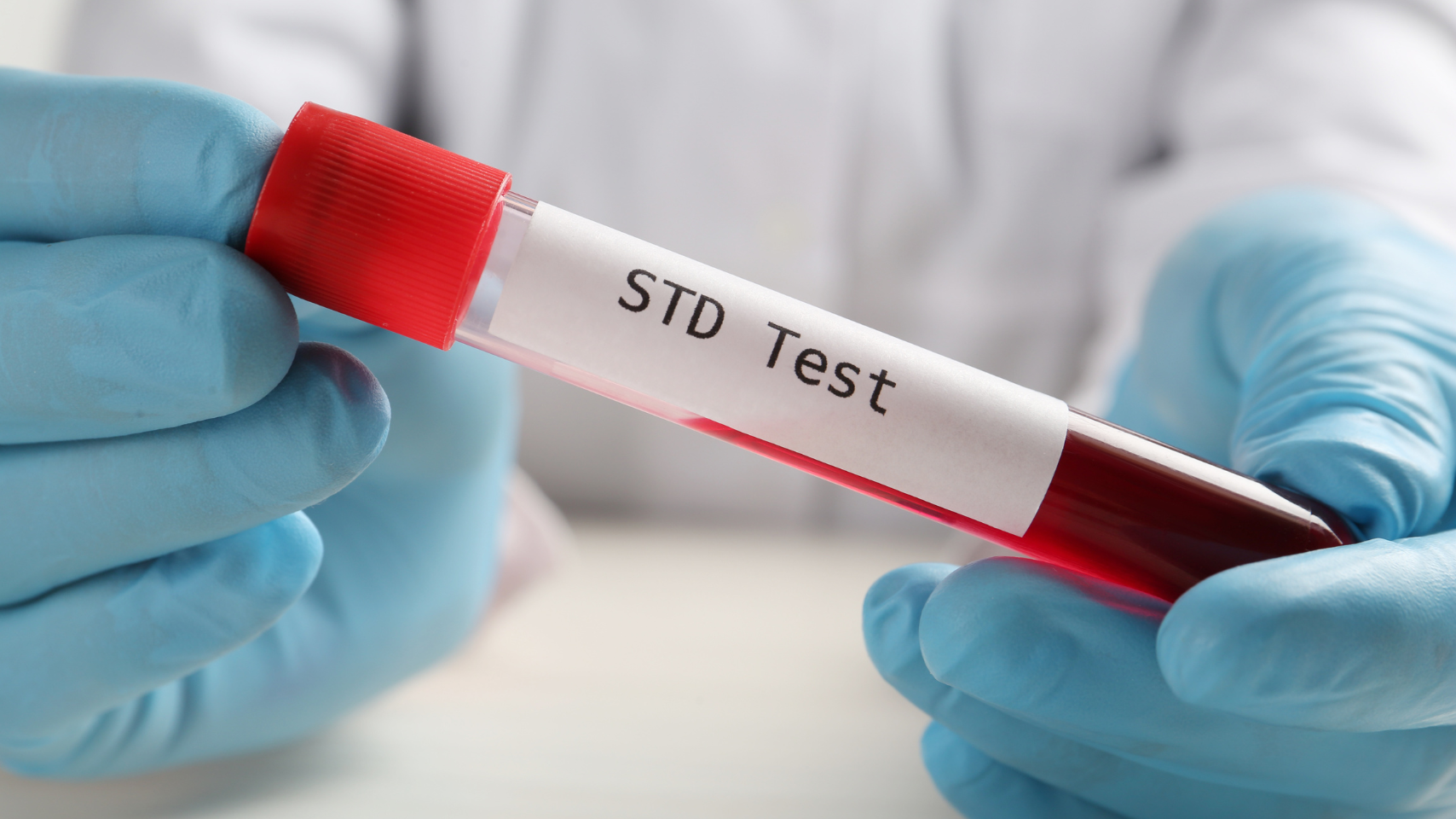 STD test Barcelona