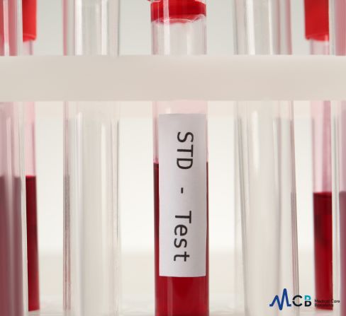 std test