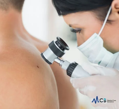 Expert Dermatologist in Barcelona